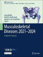 musculoskeletal diseaeses.jpg